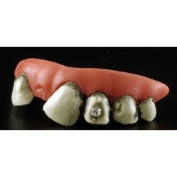 dentier-partie-du-haut-dents-pourries-avec-1-diam-s