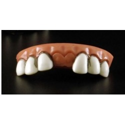 dentier-grosses-dents-manque-les-2-dents-de-devant